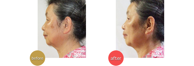 60代女性　主婦