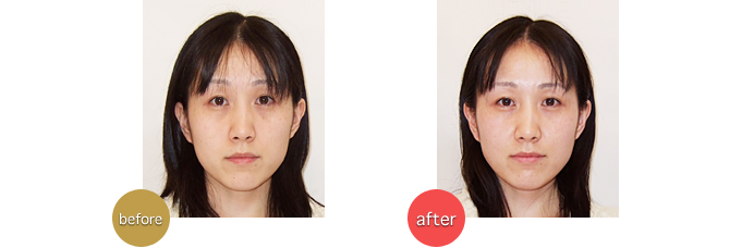 20代女性　看護師