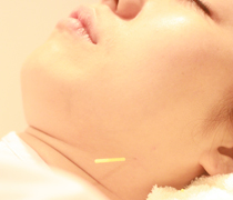 特徴１．ロイアルリアクティブポイント