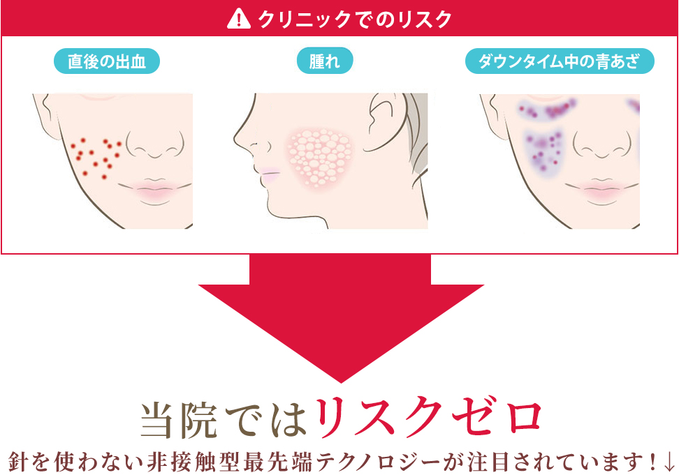 クリニックでのリスク