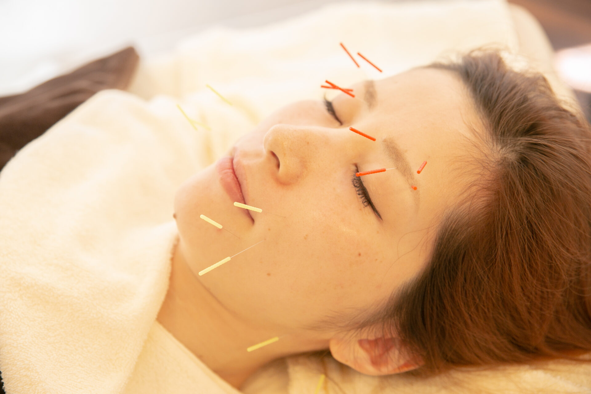 施術前のカウンセリングの様子